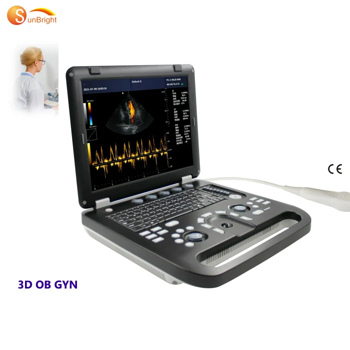 High quality portable echocardiography ultrasound machine cardiac OB GYN 3D ultrasound