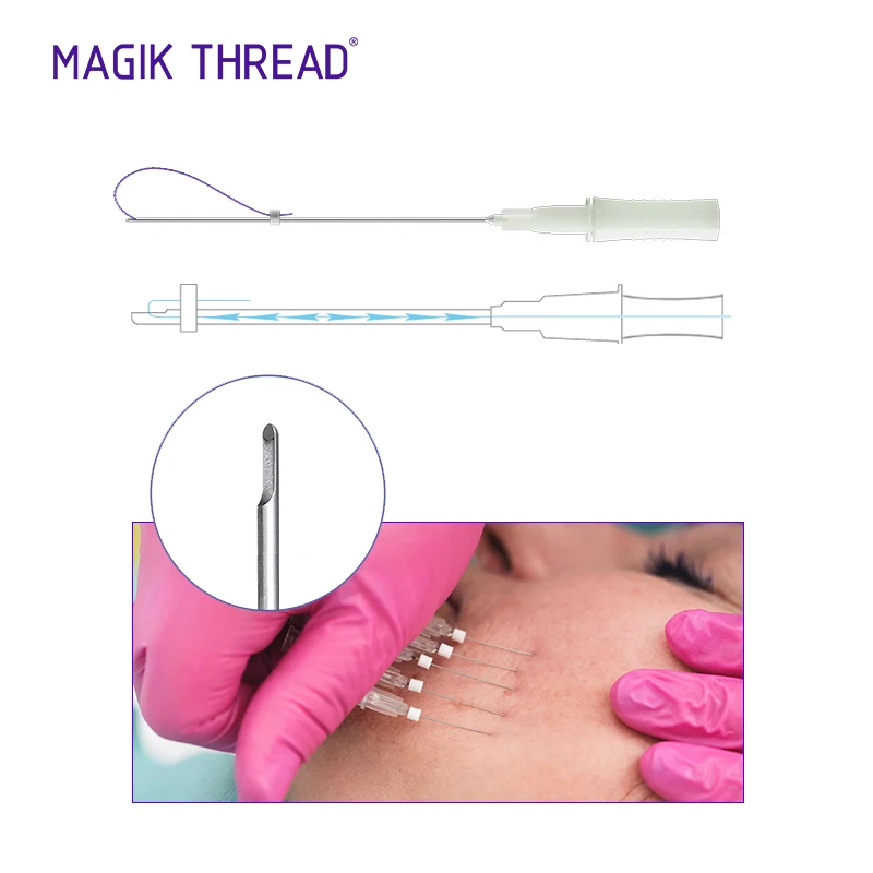 Magik Thread CE Marked barbed fios de  Pdo Thread manufacture Lifting pdo for face lift