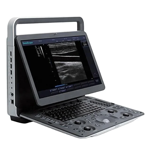 Medical Ultrasound Instruments Sonoscape E1 Black white Ultrasound machine Scanner Analyzer with Pw