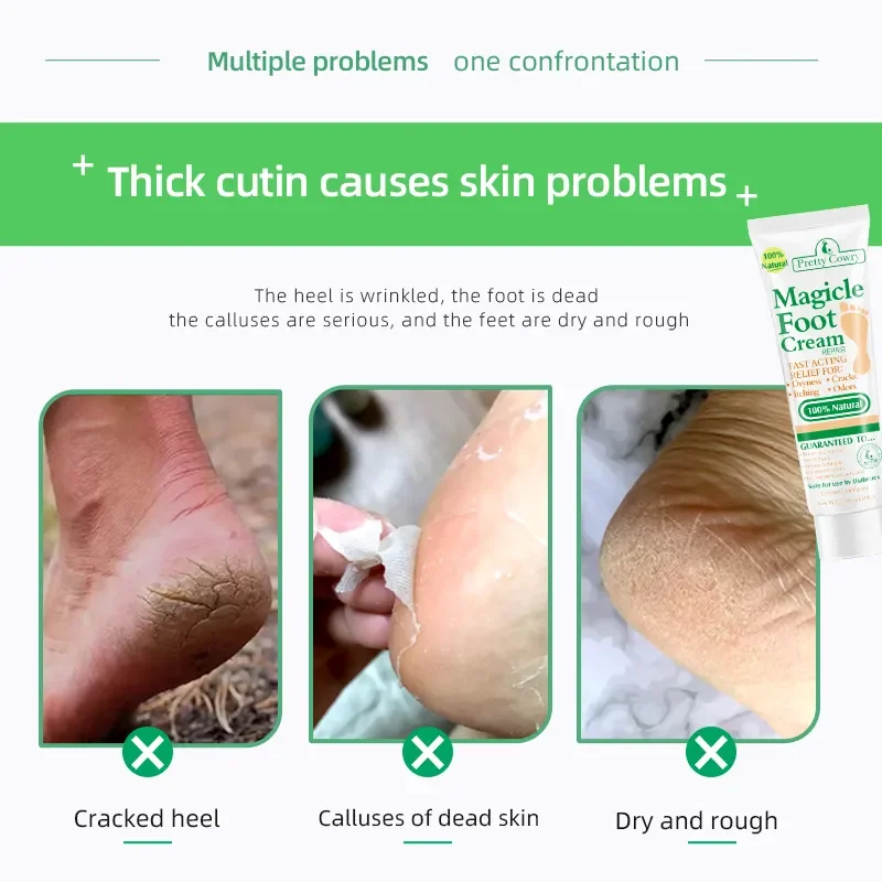 Anti-Drying Crack Foot Cream Heel Cracked Repair Cream  Moisturizing Removal Dead Skin Hand Feet Smooth Care