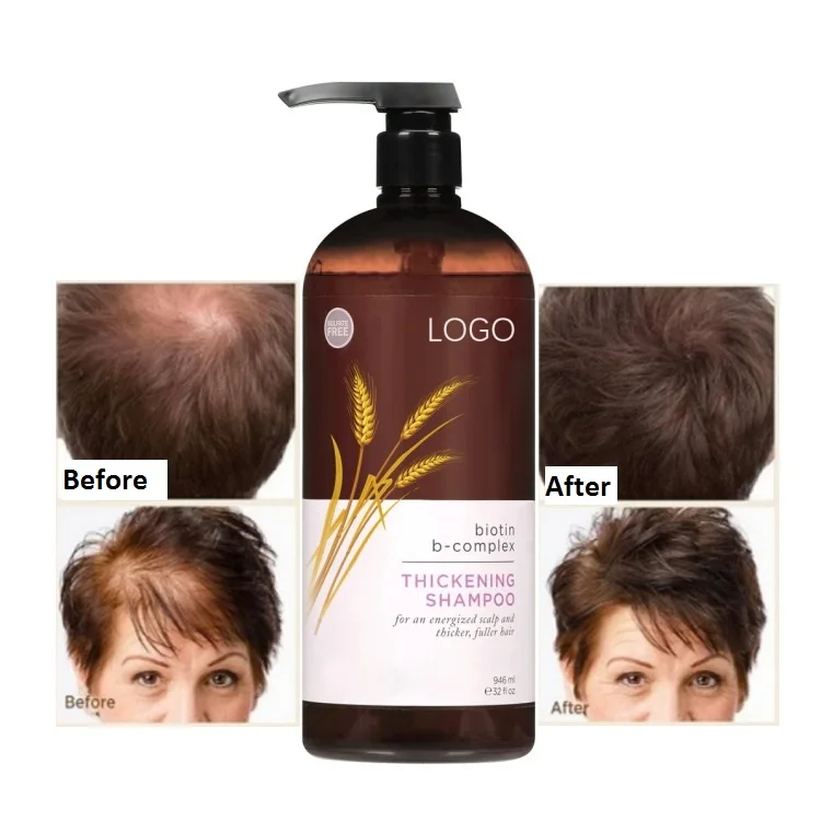 Professional High Quality Thicker Fuller Looking Anti-itchy Biotin B Complex Thickening Anti Hair Loss Shampoo