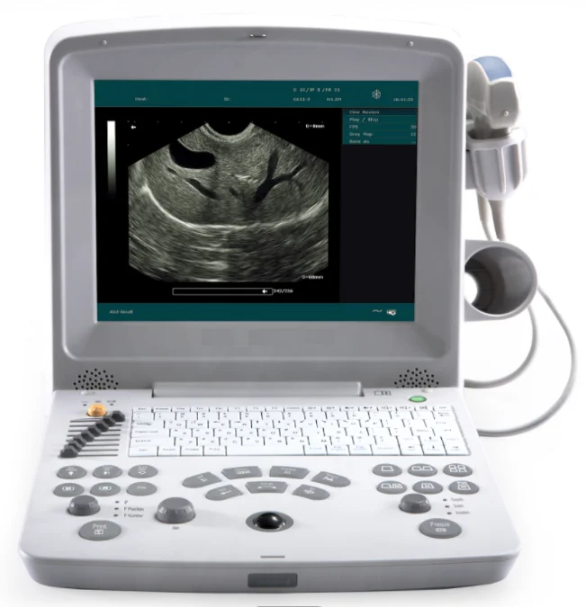 Original RS-VD100 VET Veterinary Digital Ultrasonic System Ultrasound Vet Portable Black and White Ultrasound Cheap Price