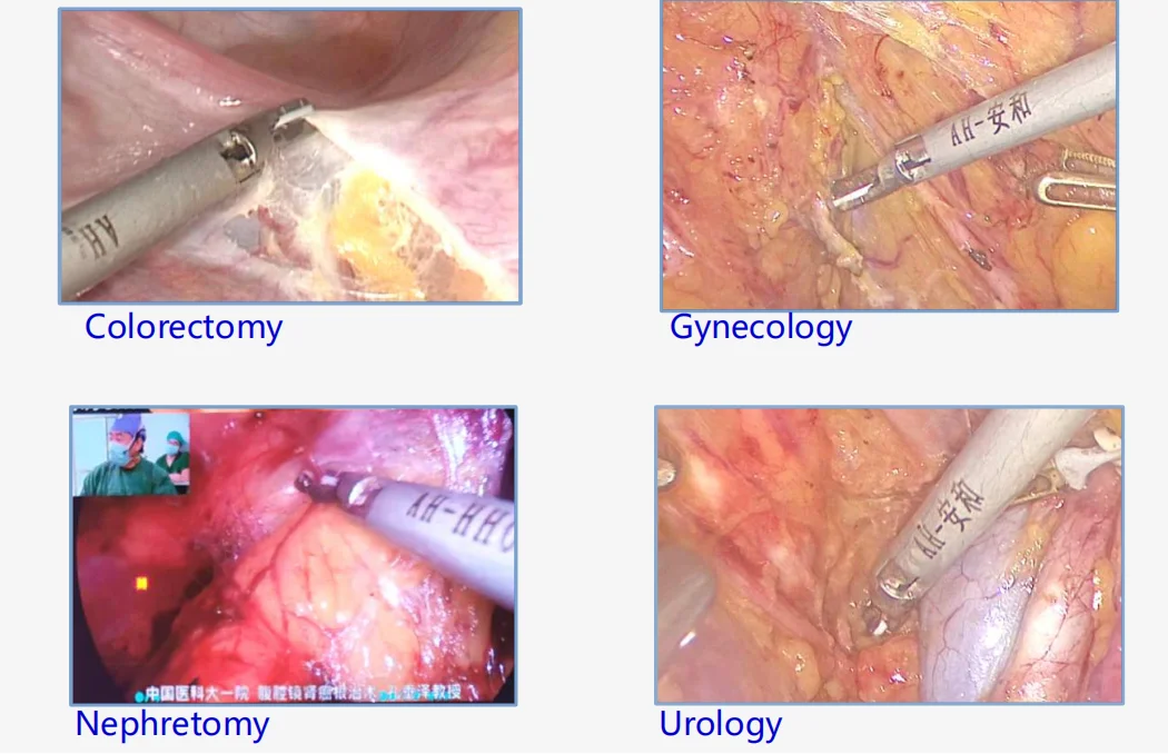 affacare AH-600 ultrasonic scalpel ultrasonic shear ultrasonic cutter ultrasonic scalpel generator