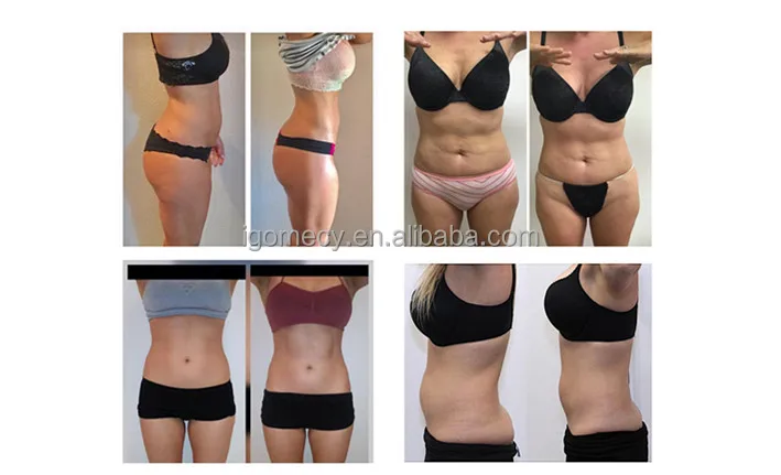 635nm-650nm-780nm-810nm-940nm-980nm-6d-Lipolaser-209mw-Light-Lipolysis-Diode-Body-Slimming-Super-Lipo-Laser-Fat-Removal-Machine