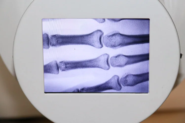 Portable x-ray, fluoroscopy machine MSLPX32