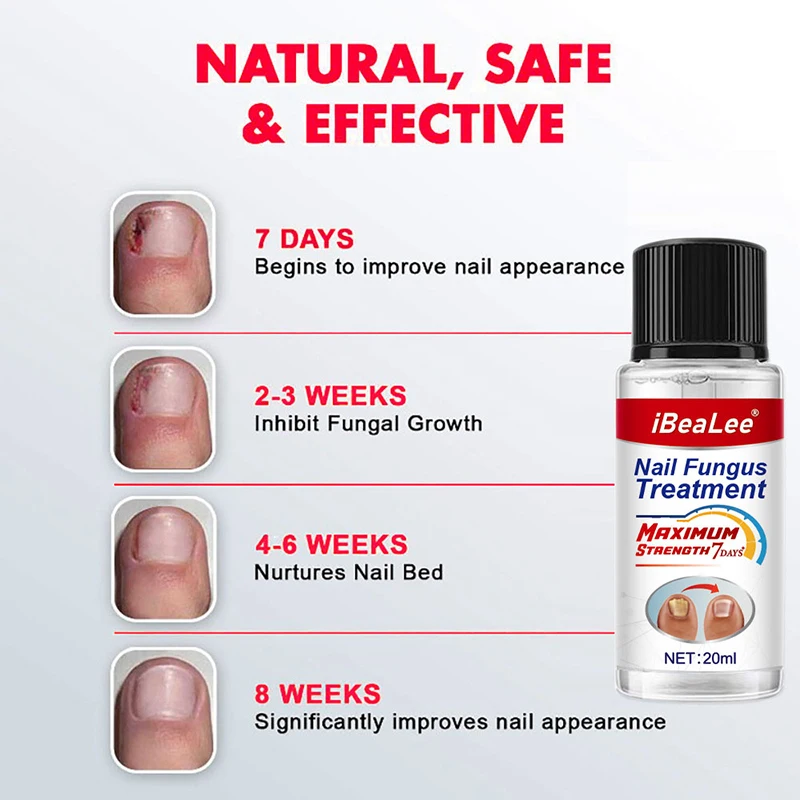 iBeaLee Nail Fungus Treatment 7DAYS Repair Essence Serum Hand Care Nails Foot Fungal Removal Cream Anti-infective Onychomycosis