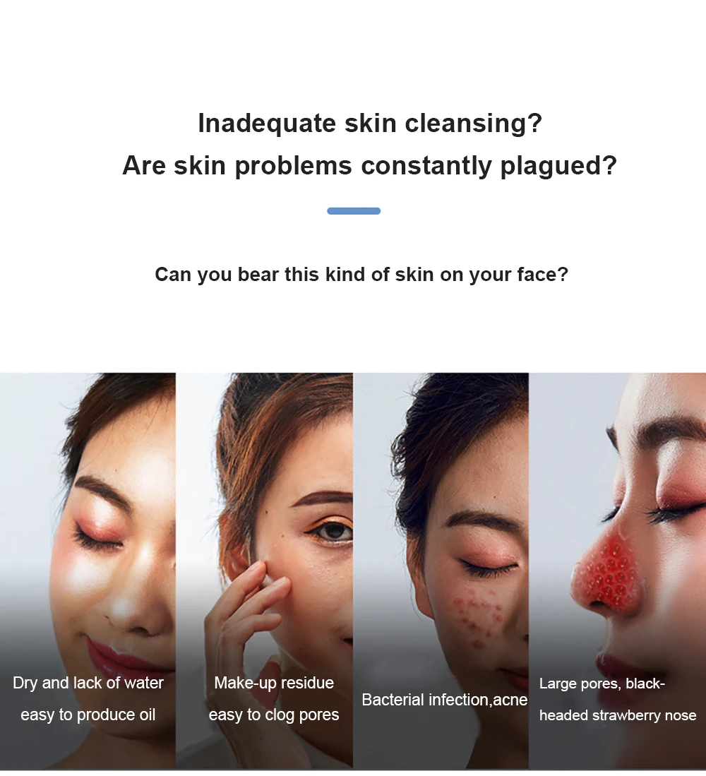 Hot Selling Facial Suction Acne Ice cool And Hot compress Blackhead Remover Vacuum Pore Remover Vacuum