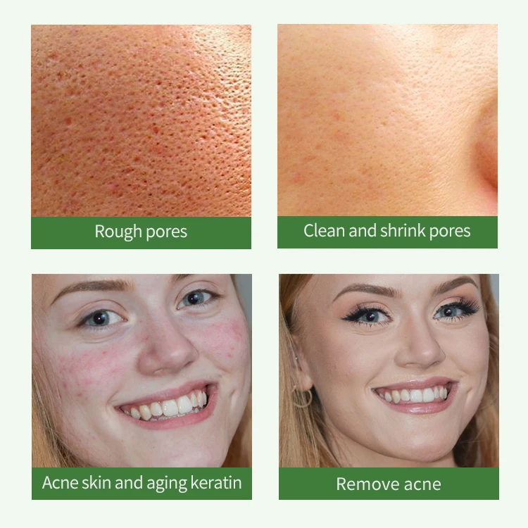 Beauty deep cleanse purifying acne super matcha face maskss green tea cleansing clay mask