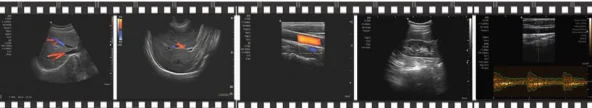 12 дюймов HD ЖК-монитор полный цифровой портативный медицинское ультразвуковое оборудование Цветной Допплер ультразвуковой