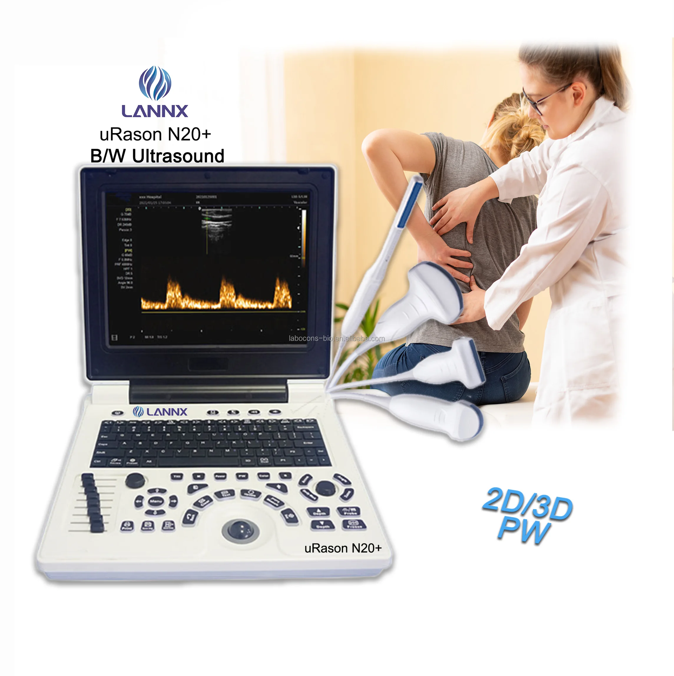Ультразвуковая диагностическая система LANNX uRason N20 + для ноутбука