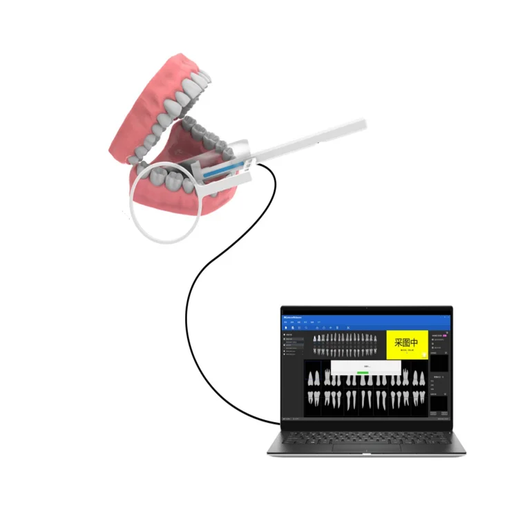 Large Size 2.0 Dental Sensor Digital Dental X-ray Image System HD RVG Sensor