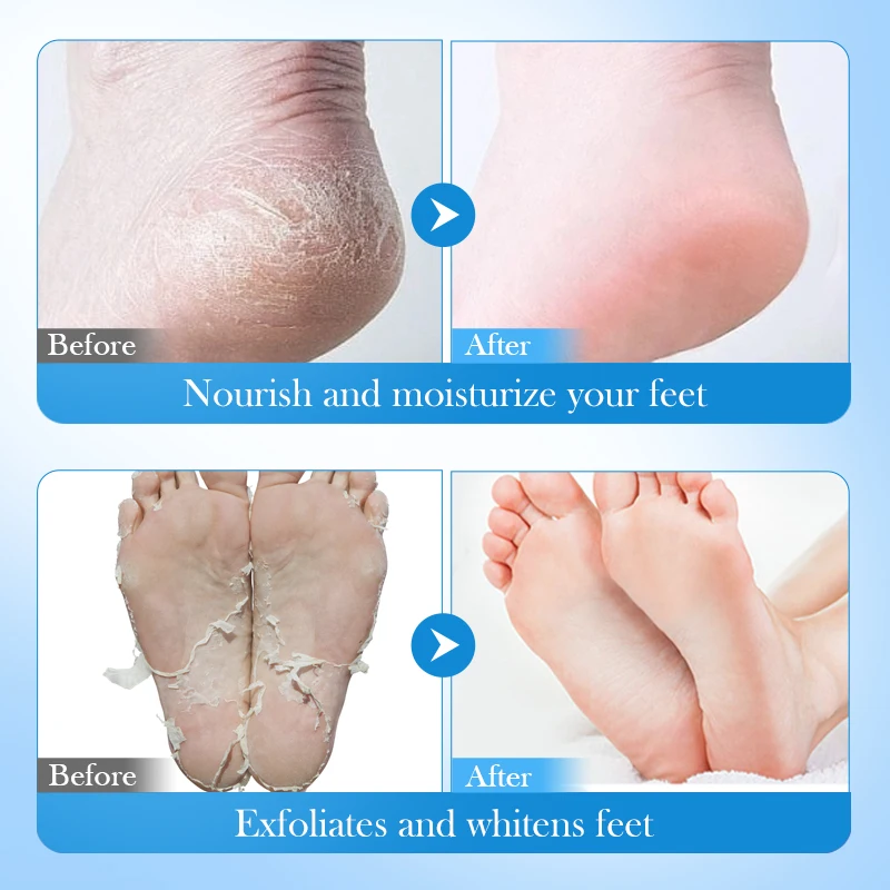 OEM FAYANKOU vegan avocado petroleum jelly moisturizing long leg mask skin care feet dead skin removal