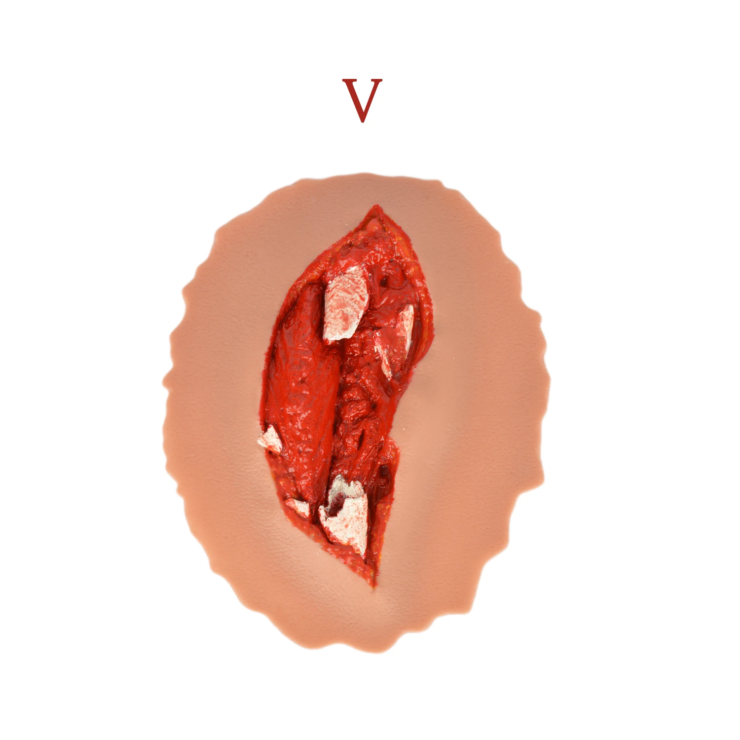 wearable open fracture trauma model for TCCC course EMT course first aid training Pre-hospital emergency care