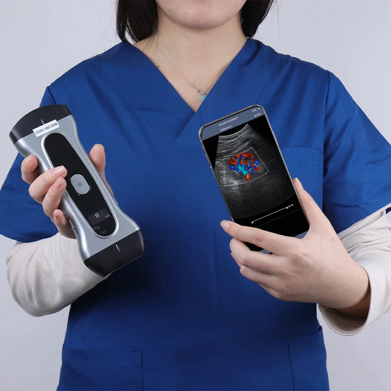 Yonker wifi wireless mini Double probe cow pet Vet handheld pregnancy scanner portable ultrasound machine veterinary for animals