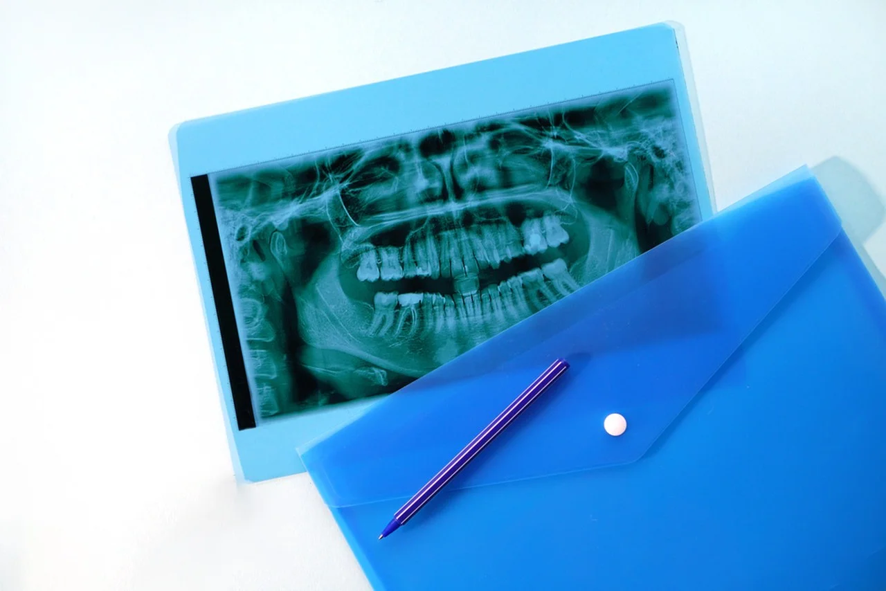175mic 215mic High Definition  Medical imaging CT DR inkjet blue film medical x-ray pet film A3A4 transparent blue printing film
