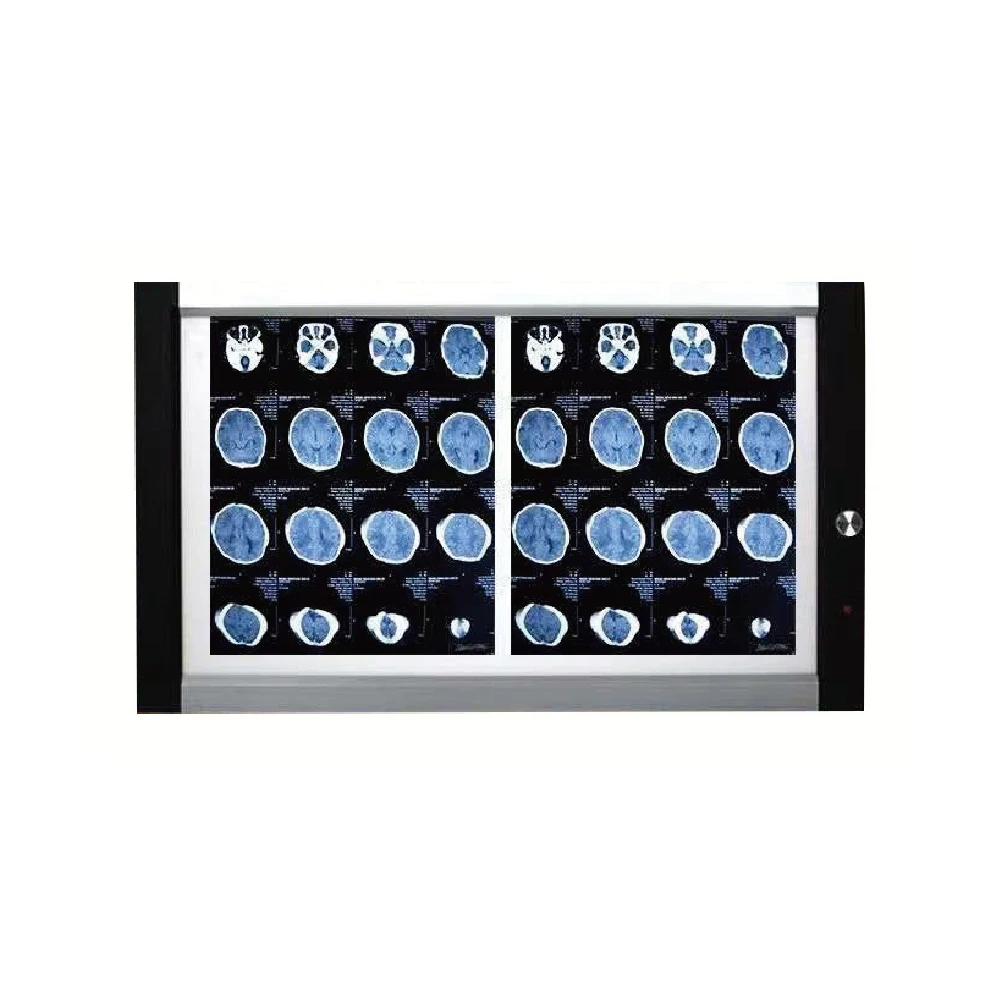 LED X Ray Negatoscope Lamp Digital CR View Box Medical Mammography X-ray Film Viewer