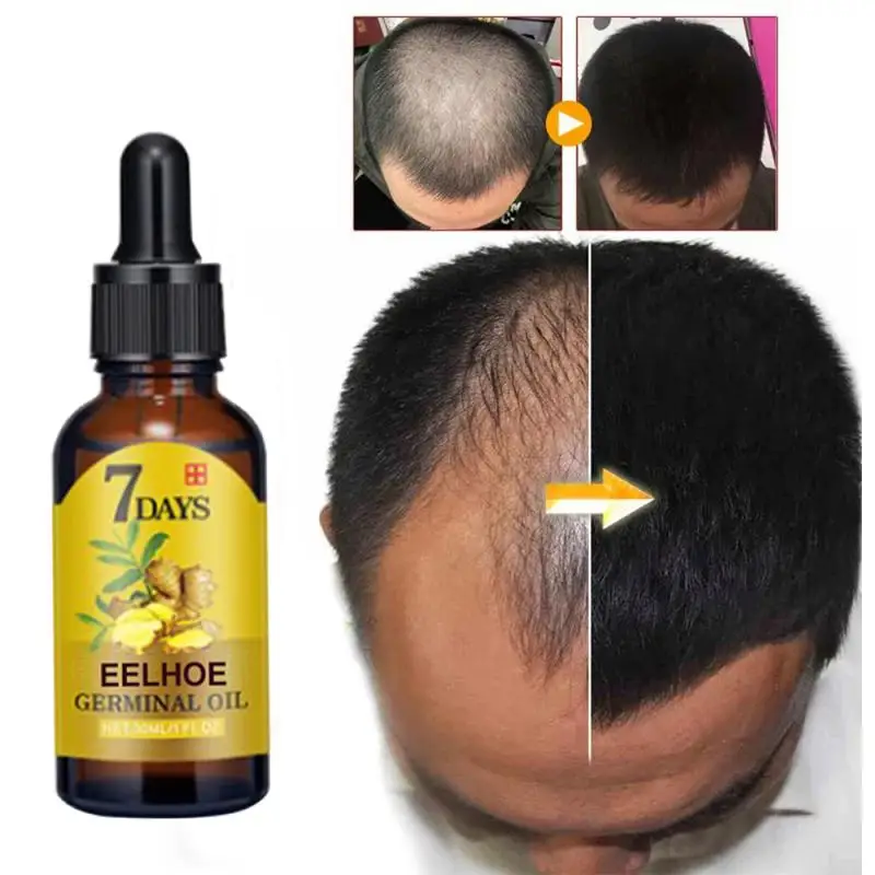  Pro Ginger тоник для волос Hair OilTreatment быстро растущий питательный и увлажняющий уход за