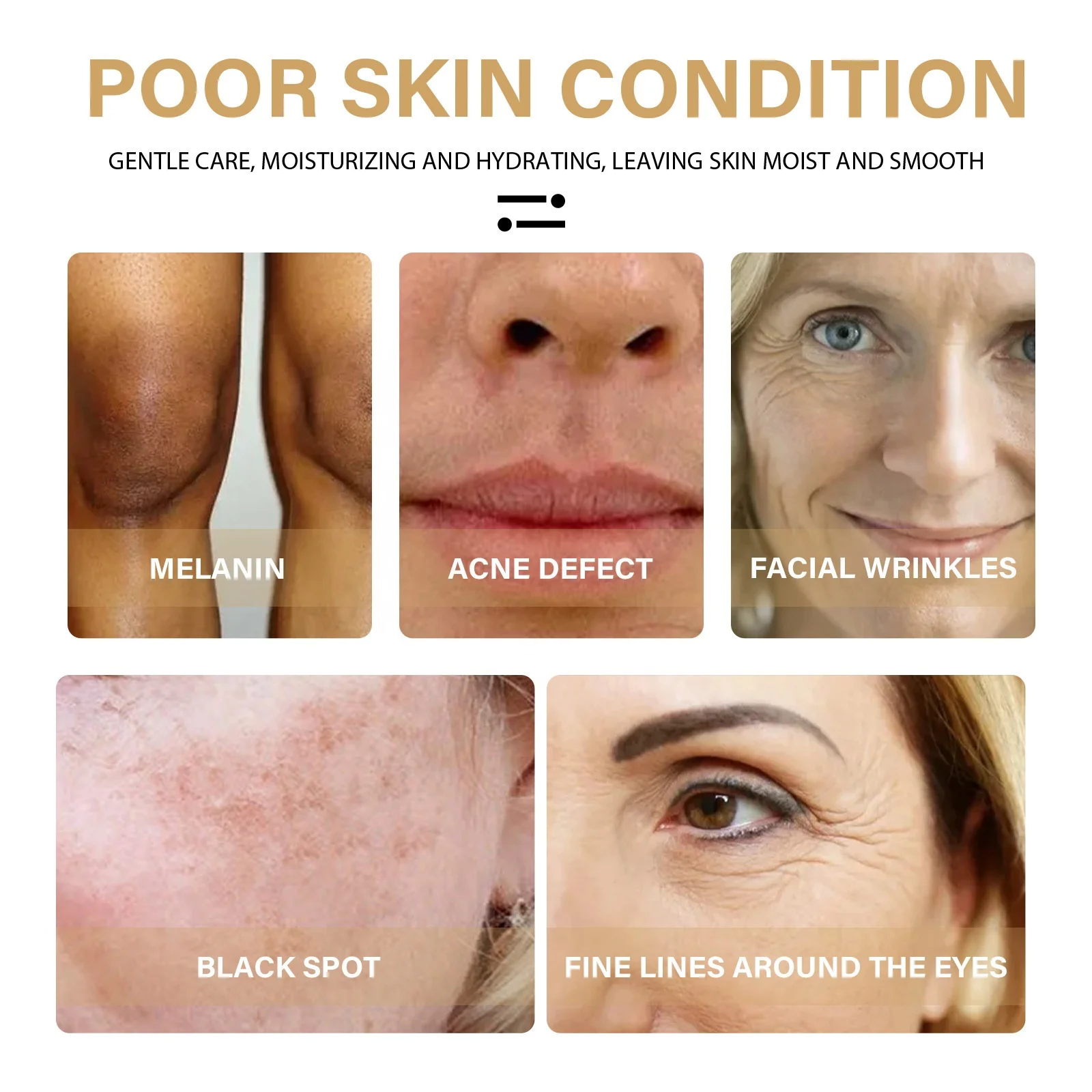 Wholesale Customization Turmeric Toner organic vegan  acne private label turmeric skin care set wholesale