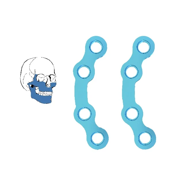 Best Seller ZMD Manufacturer Orthopedic Implants Maxillofacial System Arc Bridge Plate 1.0mm Thickness Locking Plate