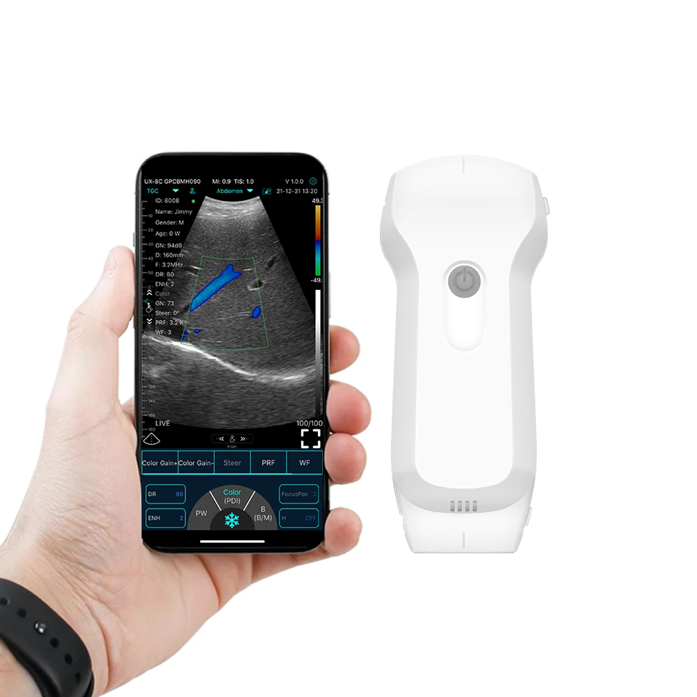 Wireless Portable USB&Wifi 3-In-1 Color  Doppler Ultrasound  Convex&Linear Probe  for Abdomen&Superficial Diseases