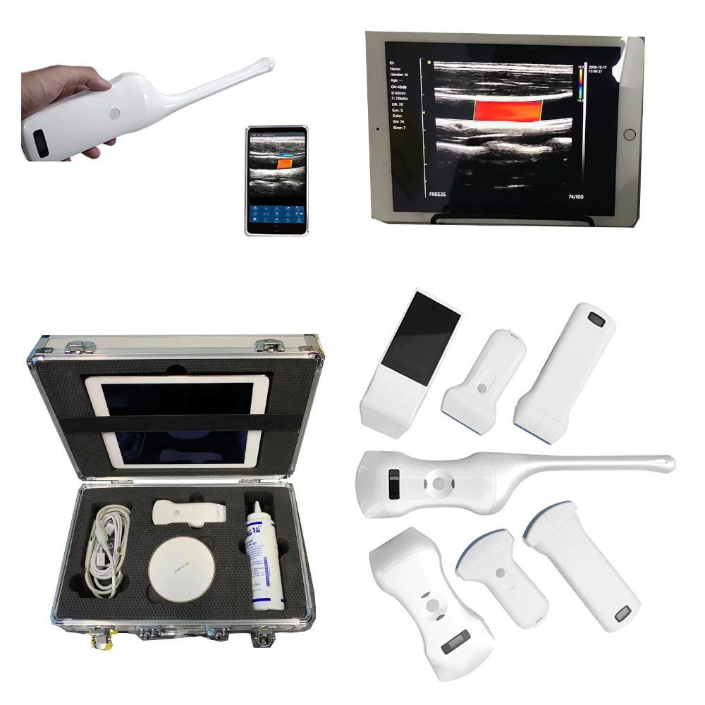 Emergency Ultrasound Device