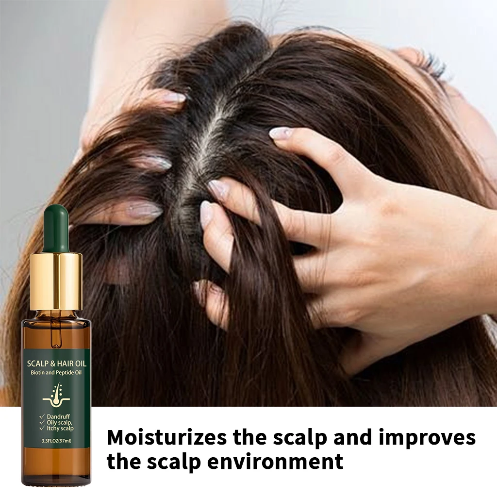 Natural plant hair scalp massage essential oil, activates the scalp, repairs damaged hair, reduces dandruff and scalp itching