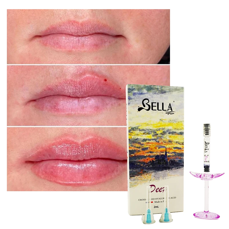 Bella Dermal Filler Hyaluronic Acid Gel Injectable With Lido Fillers For The Face Injection OEM/ODM