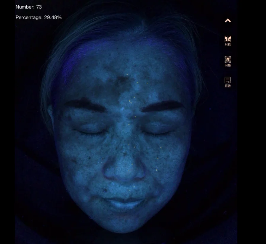 Factory Price Five Spectrum Skin Analyzer