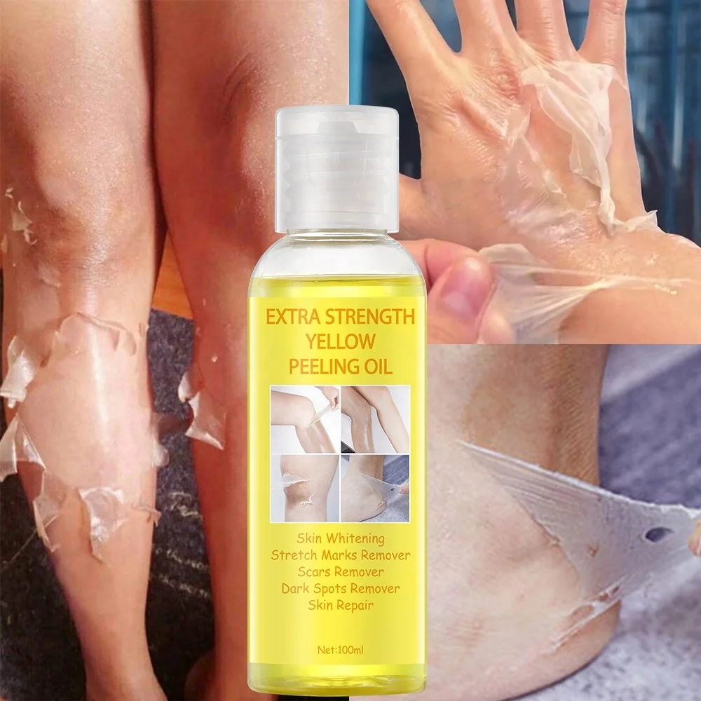 HOT Sale OEM Super Strength Yellow Peeling Oil Black Skin Strong Bleaching Oil Skin Remover African Whitening Yellow Peeling Oil