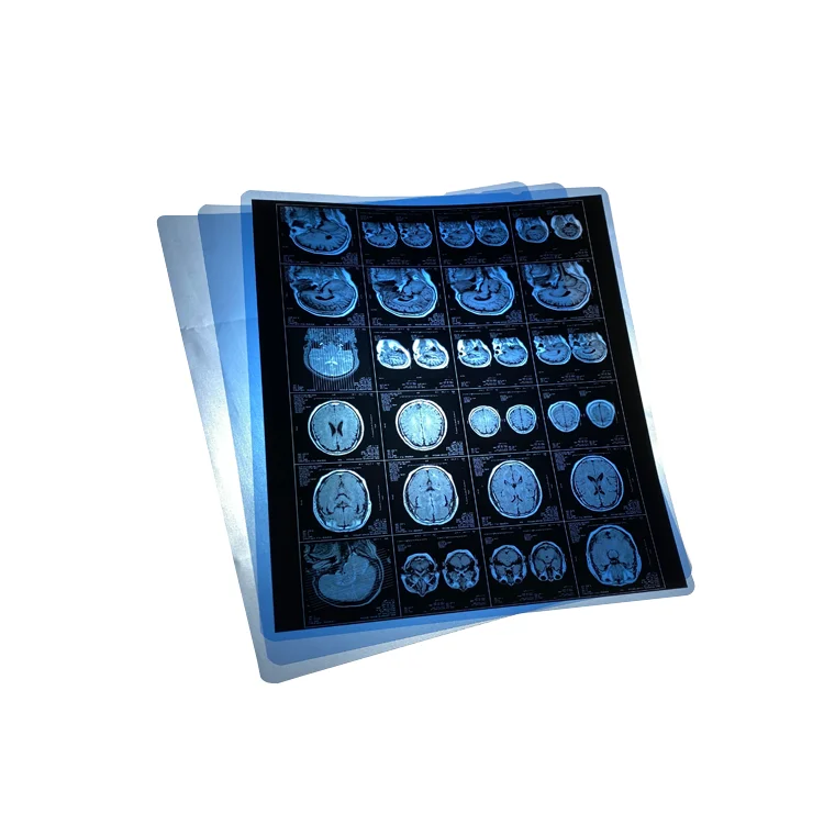 Inkjet Medical Printing Blue Film PET for Hospital X ray