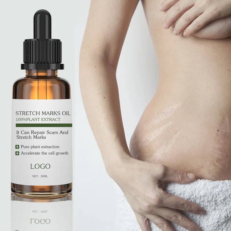 OEM Custom Private Label 100% Natural Plant Extract Body Care Oil Scar Repair Anti Stretch Mark Remover Essential Oil