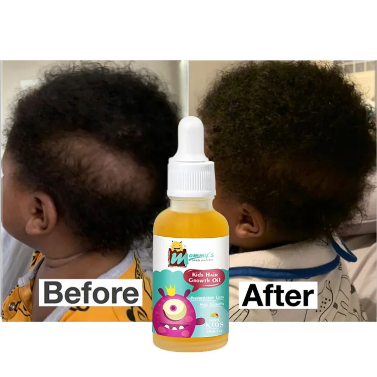 Natural & Moisturizing Best Coconut Baby Hair Massage Oil Natural For Newborn