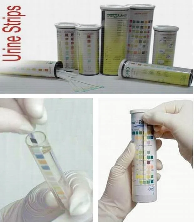 urine test strips URS-10A 100pieces/bottle