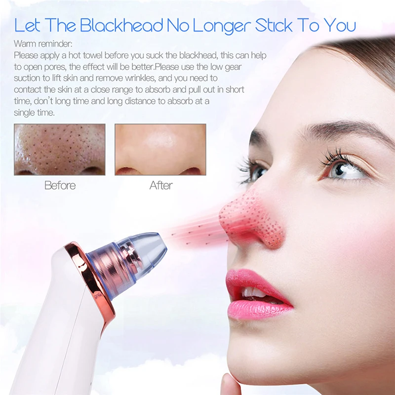 Electric Pore Vacuum Blackhead Remover Face Facial Cleansing Blackhead Remover Vacuum