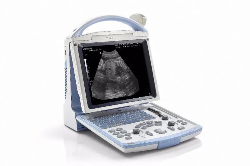 Best Mindray DP10 Professional Black & white ultrasound machine