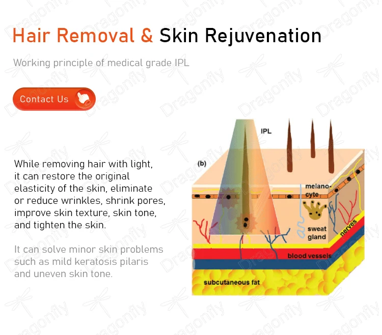 Professional Painless IPL Hair Removal Uk Lamp Medical Permanent Pain-free Laser Ipl System Machine