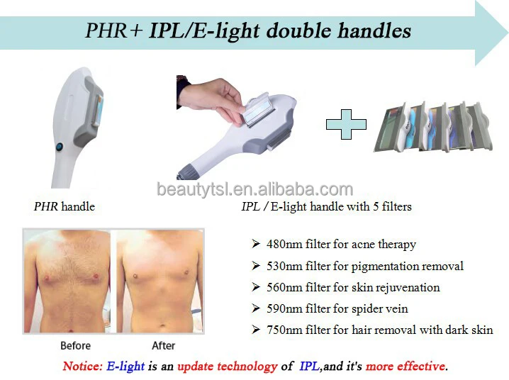 TSL-1121S2 ipl machine 5