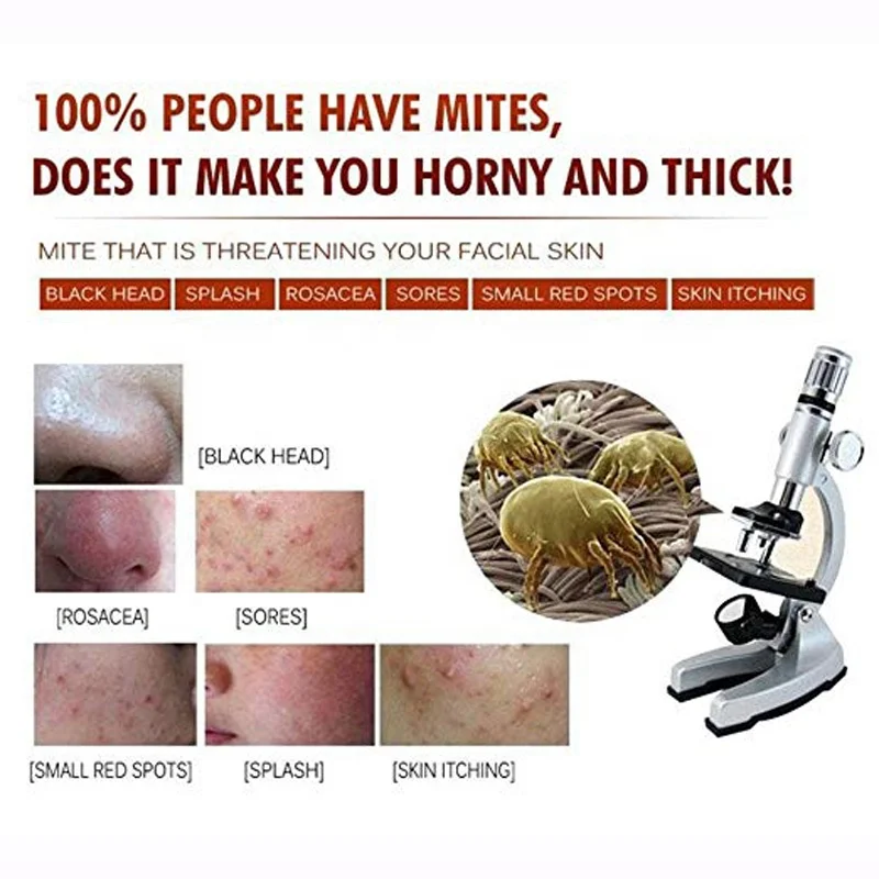 30g face Acne Treatment Pimples Removal Cream