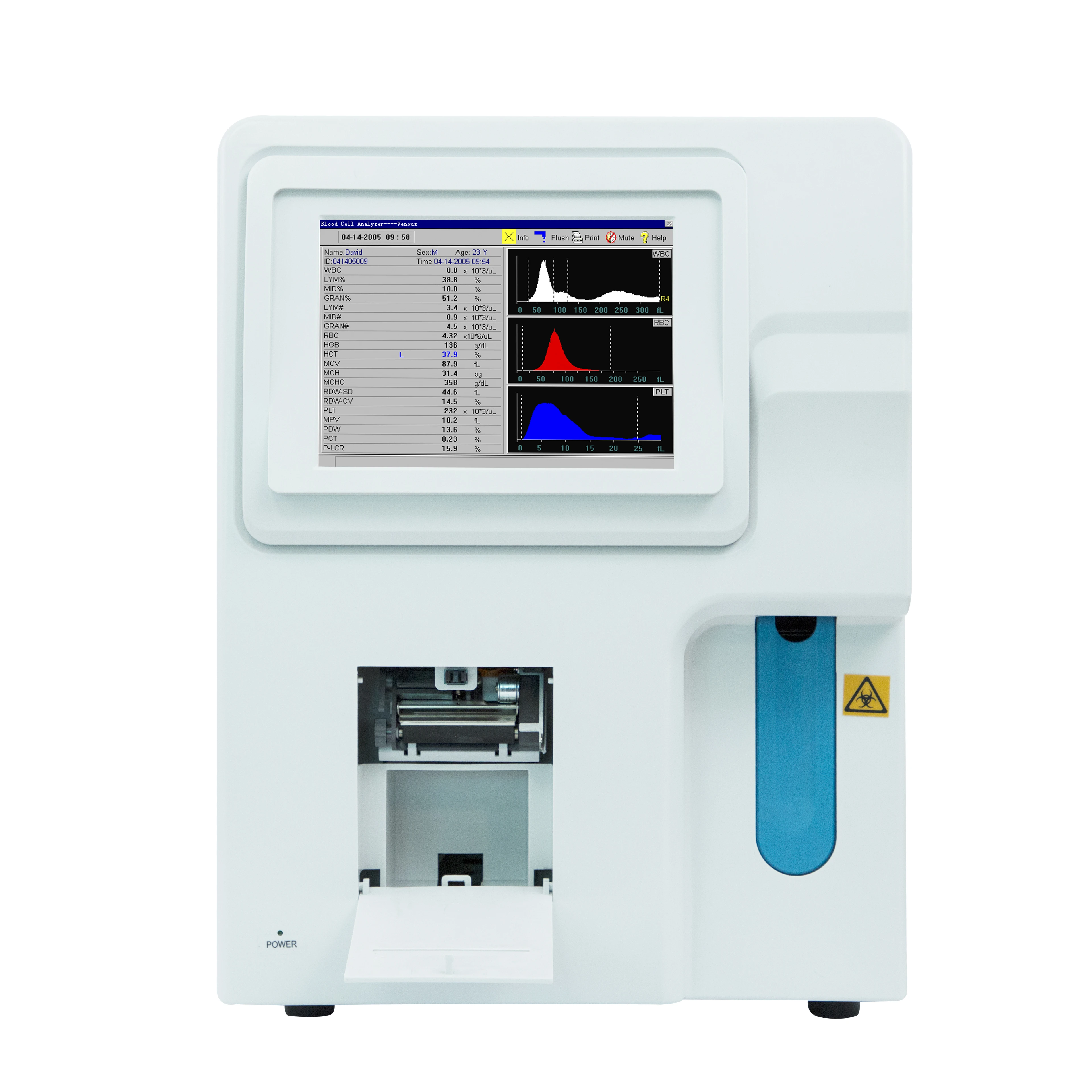 SoyMed Open System CBC equipment/ veterinary hemogram auto hematology analyzer blood