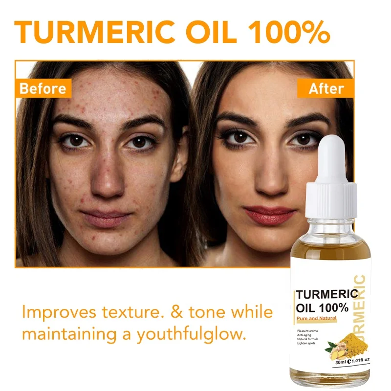 Turmeric Skincare Set Anti Acne Whitening Private Label Toner Serum Cream Face Wash Turmeric Skin Care Set