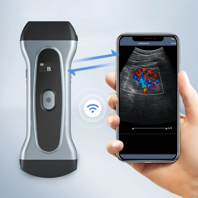 Yonker wifi wireless mini Double probe cow pet Vet handheld pregnancy scanner portable ultrasound machine veterinary for animals