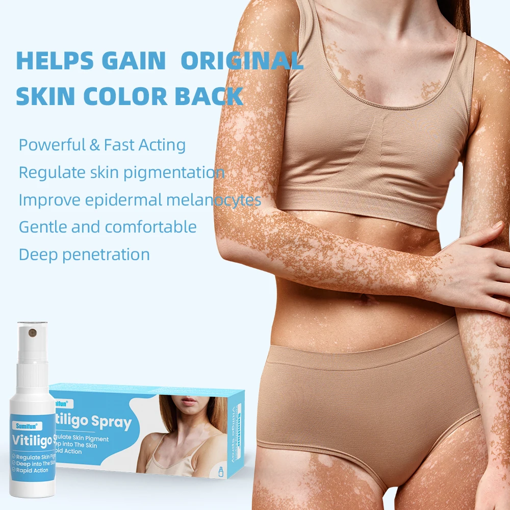 Sumifun Wholesale 30ml Vitiligo Treatment Remover Spray White Spot Skin Care Spray