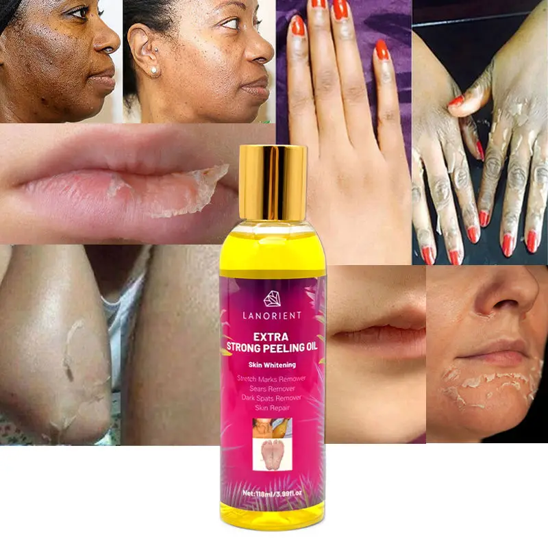 OEM LANORIENT Organic Vitamin E Black Skin Lightening Oil,yellow Oil Skin Bleaching Body Oil,Private Label Whitening Peeling Oil