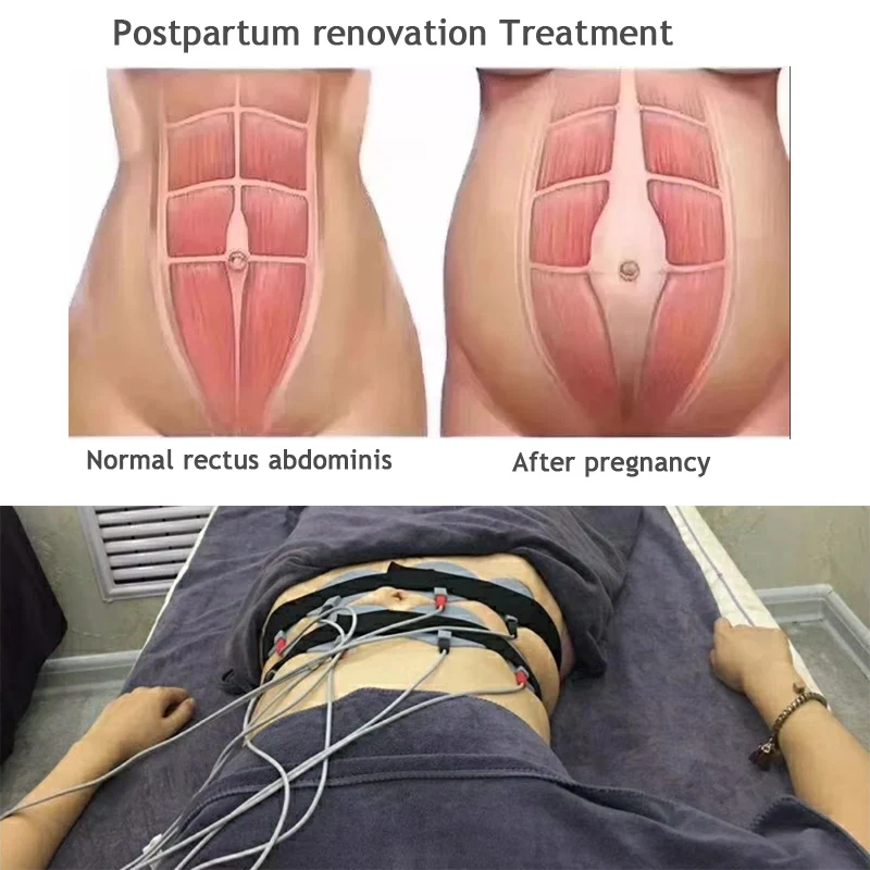 AURO Portable Tens Ems Machine Muscle Pain Relief Ems Weight Loss Body Slimming Stimulator Microcurrent Russian Waves Machine