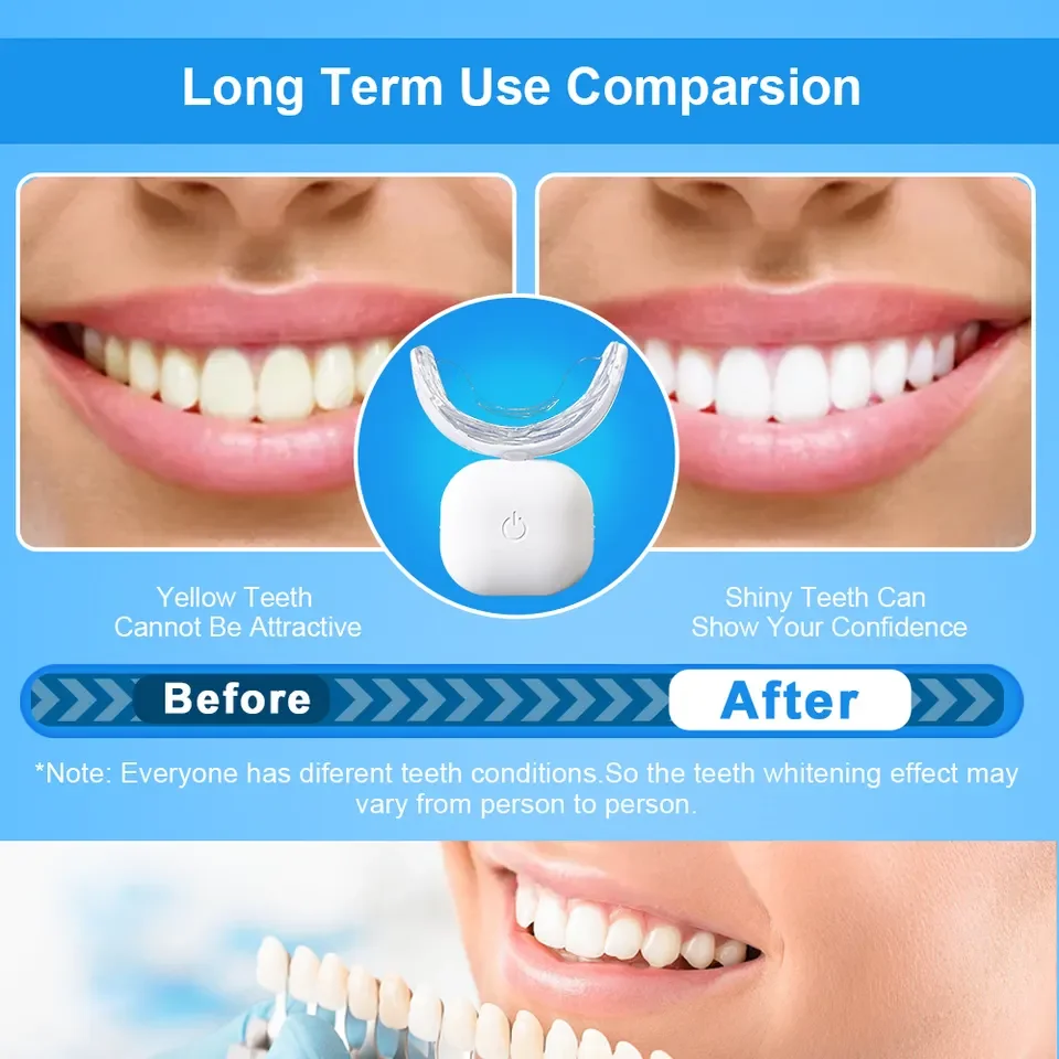 Mini Teeth Whitening LED Light Wireless 15 Mins Effective Bleaching Teeth Whitening Light 32 LED Tooth Whitening Blue Red Light