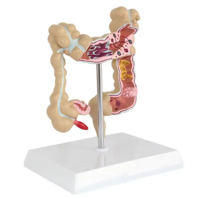 Advanced Medical Supplies Human Teaching Large Intestine Anatomy Model For School and hospital