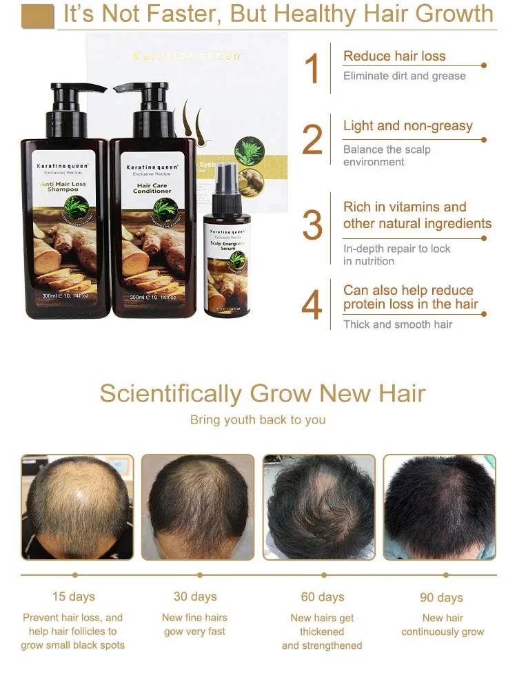 OEM/ODM производство Гуанчжоу Природный Имбирь против выпадения волос образцы лечения роста