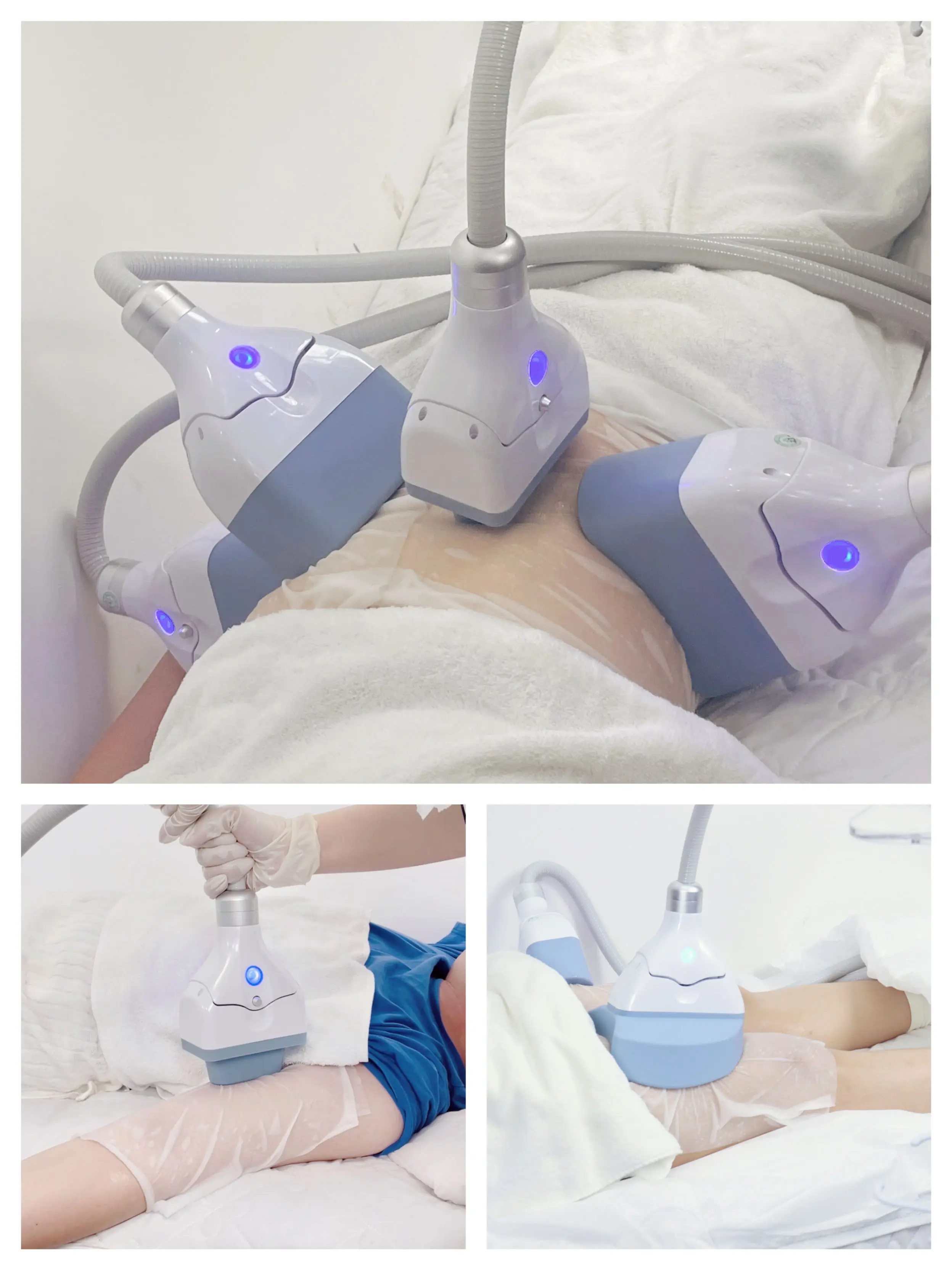 S10 criolipolisis portatil slimming machine cryotherapy criolipolisis machine with two handles