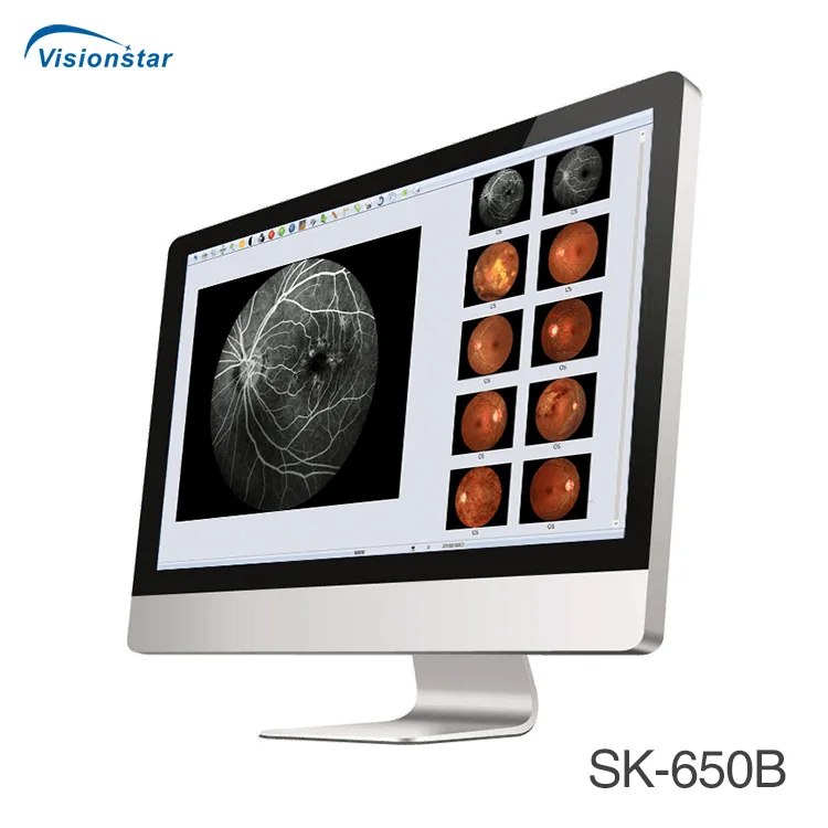Popular Model SK-650B Non-mydriatic Fundus Camera