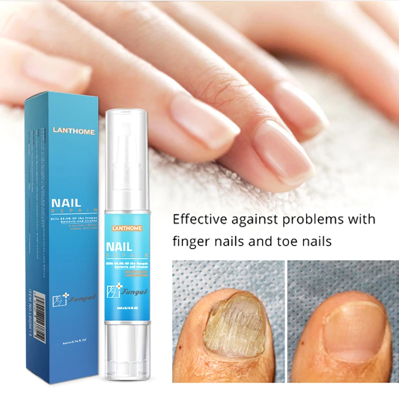 Private Label Antifungi Oil Fungal Infection Treatment Nail Repair